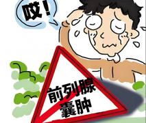 前列腺囊肿术后该怎么护理