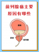 前列腺痛的病因是什么